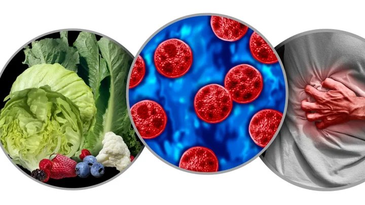 Confirmed cyclospora cases surpass 17,000. See map of affected states